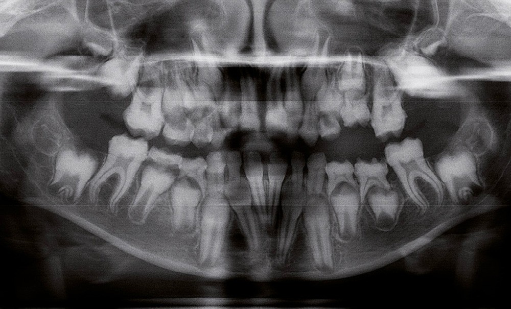 scopri come l'intelligenza artificiale sta rivoluzionando le diagnosi tramite radiografie, migliorando l'accuratezza e la tempestività nelle scelte cliniche.